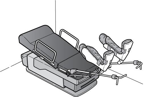 Illustration showing an exam table with adjustable lower leg supports.