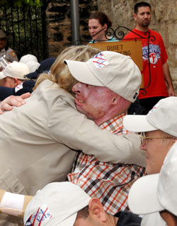Photo: A woman hugs a man wearing a ball cap. He has severe burn scars on his face, ears, and hands.